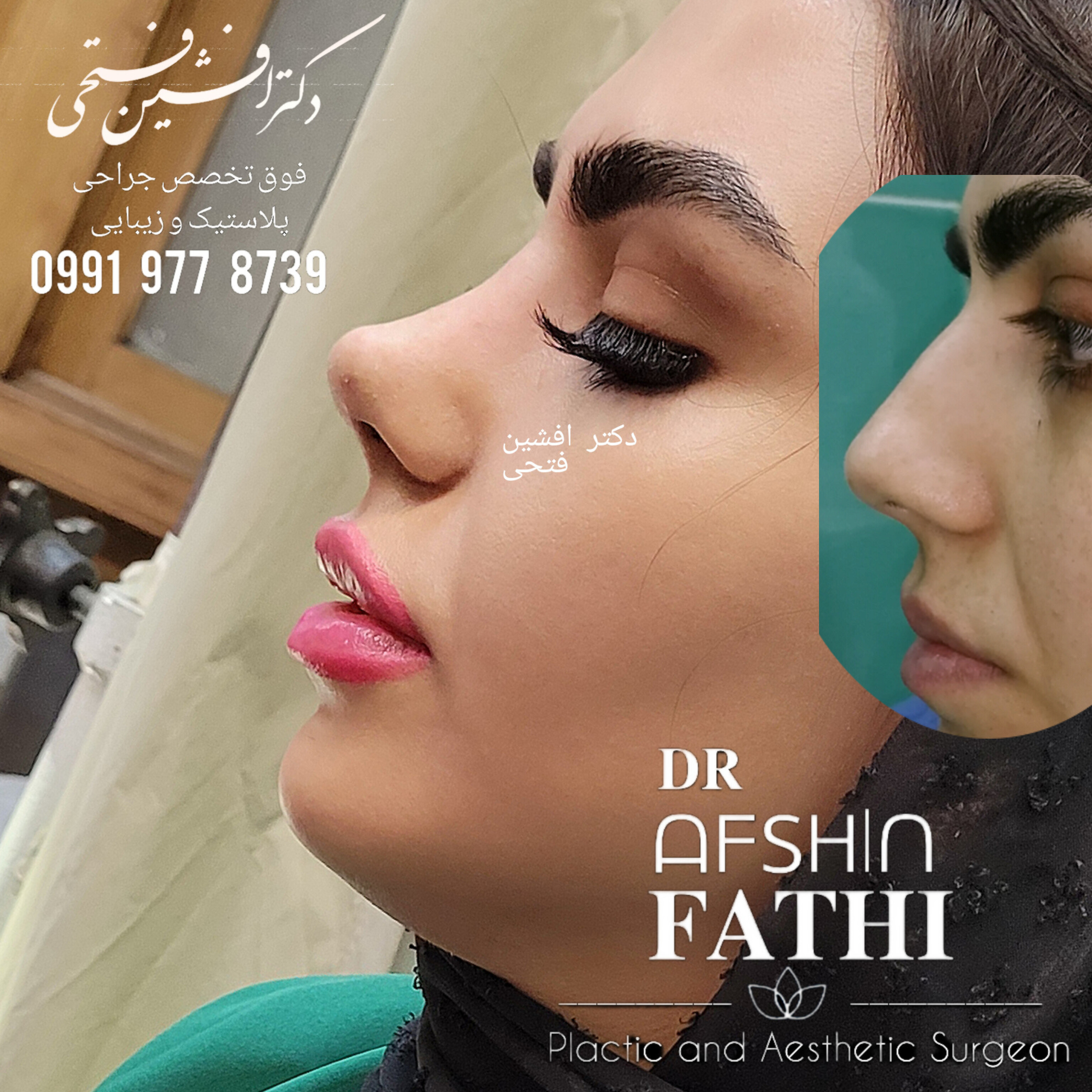 نیمه فانتزی دخترانه 