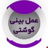 عمل بینی گوشتی با دکتر فتحی، ترکیبی از دقت جراحی و زیبایی