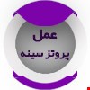 جراحی پروتز سینه با هدف ایجاد فرم طبیعی و متناسب.