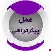ایجاد فرم طبیعی و متناسب در بدن با تکنیک‌های پیشرفته