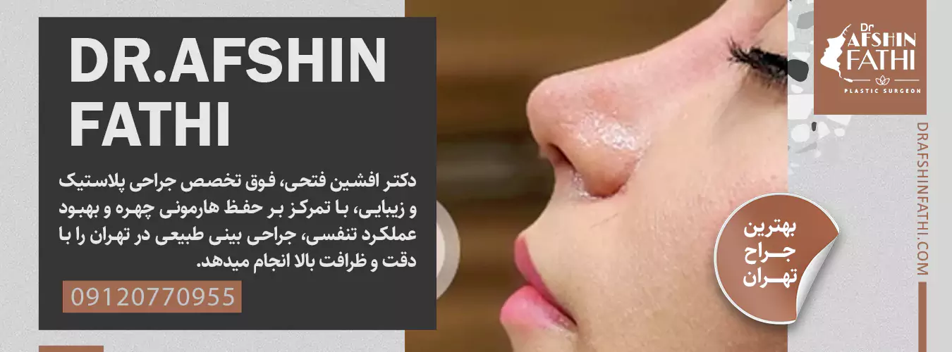 جراحی بینی طبیعی در تهران توسط دکتر افشین فتحی جراحی بینی طبیعی در تهران توسط دکتر افشین فتحی