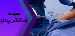  نمونه ساکشن شکم و پهلوها 
